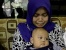 Bayi Kehilangan Sekat Diantara Kedua Lubang Hidungnya RSUD Dituding Malpraktik